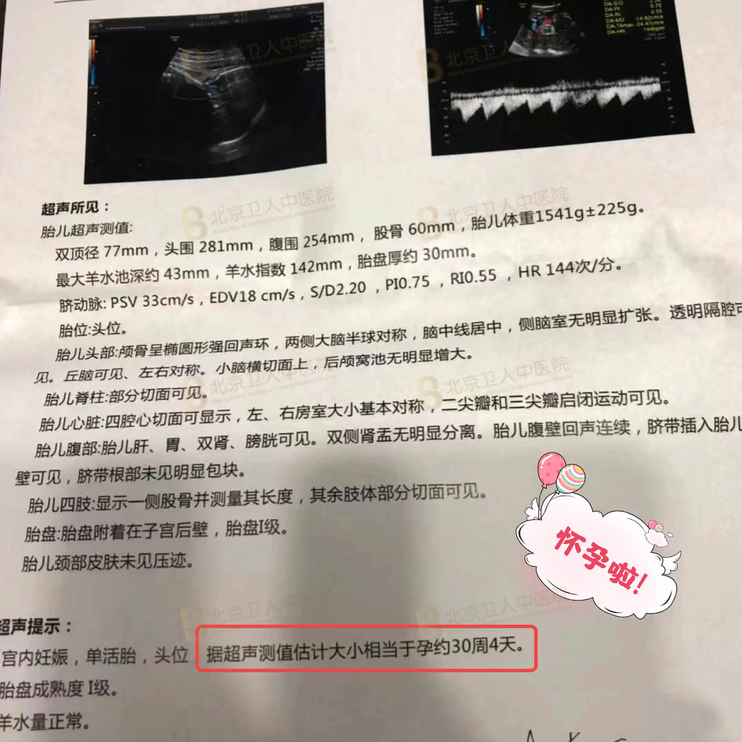 北京卫人医院孕期报告