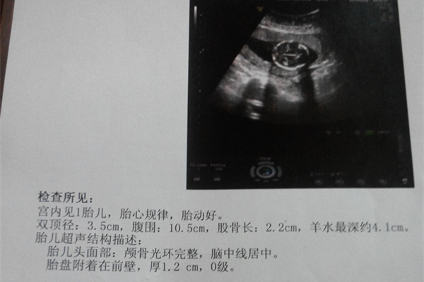 北京卫人医院检查报告